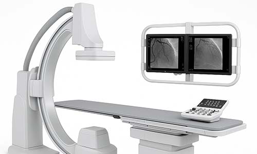 Digital Subtraction Angiography System