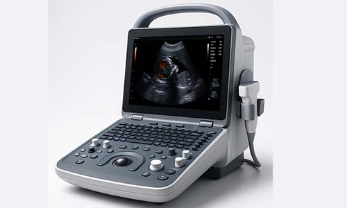 Ultrasound